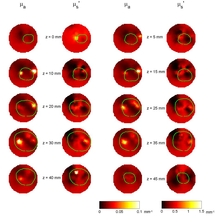 Reconstruction for Interstitial Diffuse Optical Tomography (iDOT) for Human ...