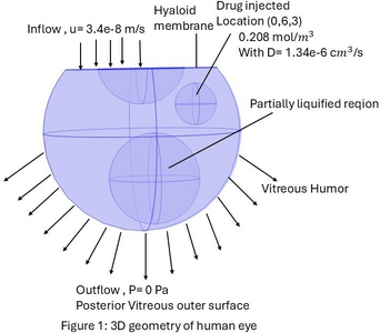 Computational Modeling of Drug Ranibizumab Transport in Age-Related Macular ...