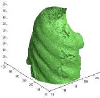 Deformable Image Registration for Pleural Photodynamic Therapy