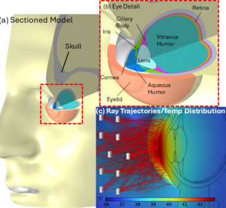 Multiphysics thermal analysis of a wearable low-level light therapy device ...