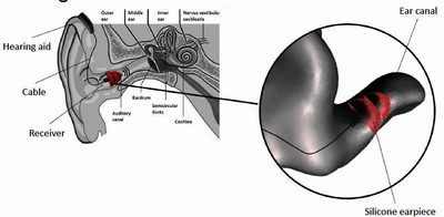Improving the Performance of Instant-Fit Earpieces by Making Use of FE ...