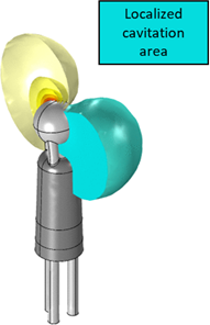 Modelling of an Innovative Directional Ultrasonic Atherosclerosis Treatment ...